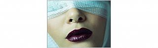 قسم الجراحة التجميلية والحروق - המחלקה לניתוחים ולכוויות פלסטיים -